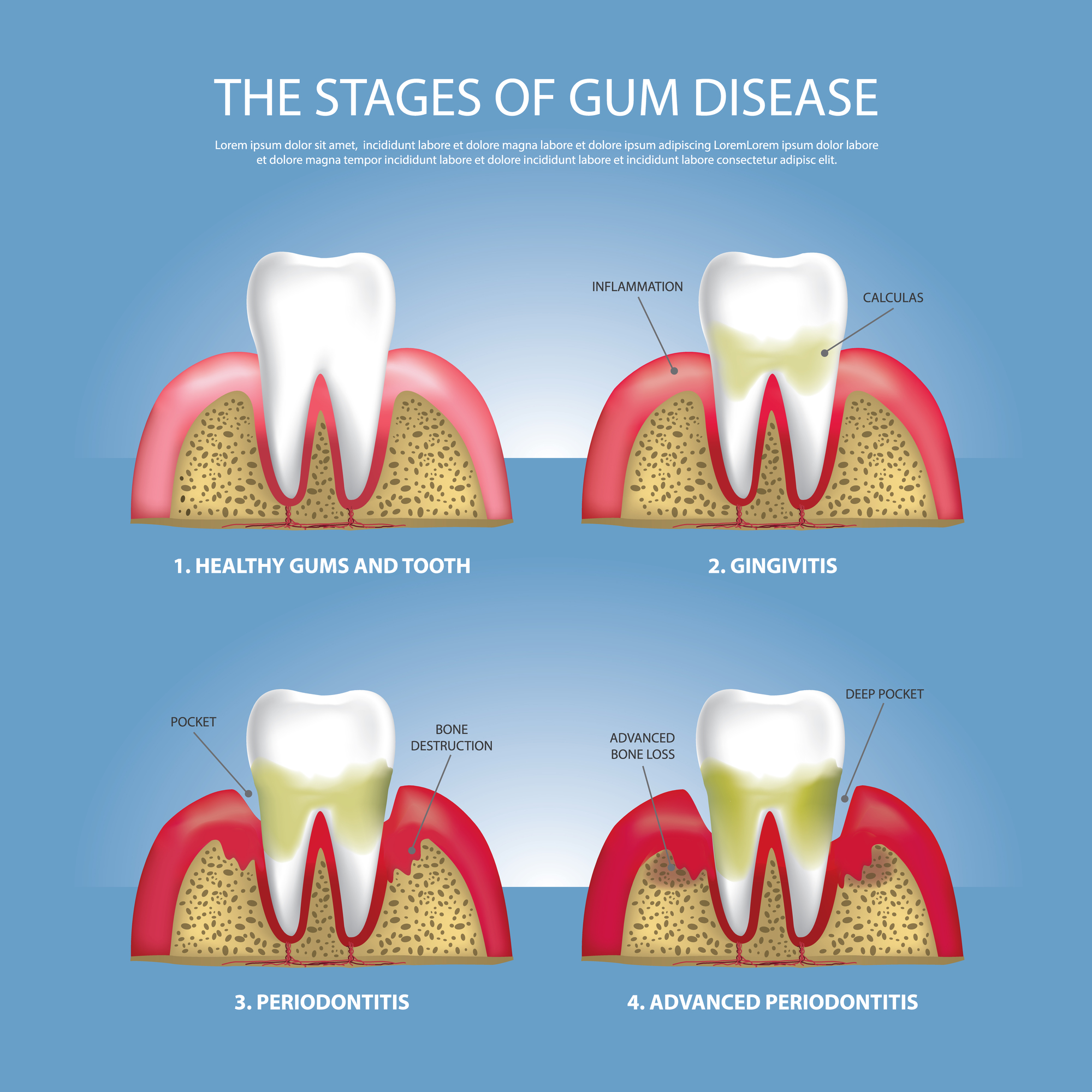 Depositphotos 168711492 l 2015 why can't tadicurange disease be cured